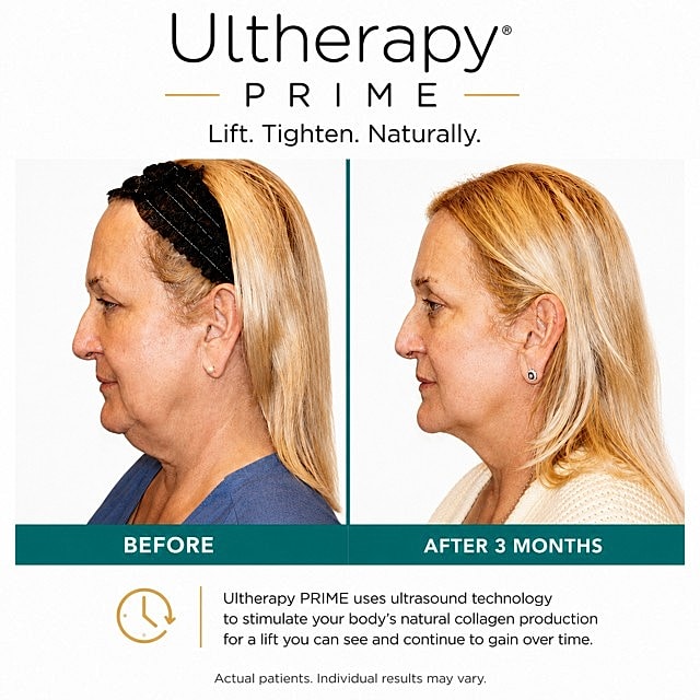 Loose Skin After Weight Loss | Skin Tightening Orlando